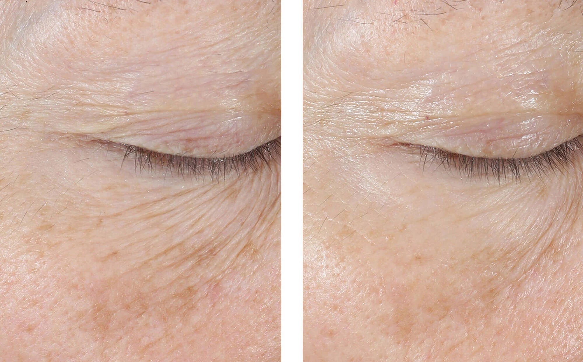 InterFuse Treatment Cream EYE