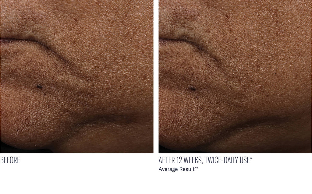 InterFuse Treatment Cream FACE & NECK